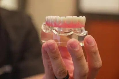 Dental implants Upland CA All on X and single tooth implants